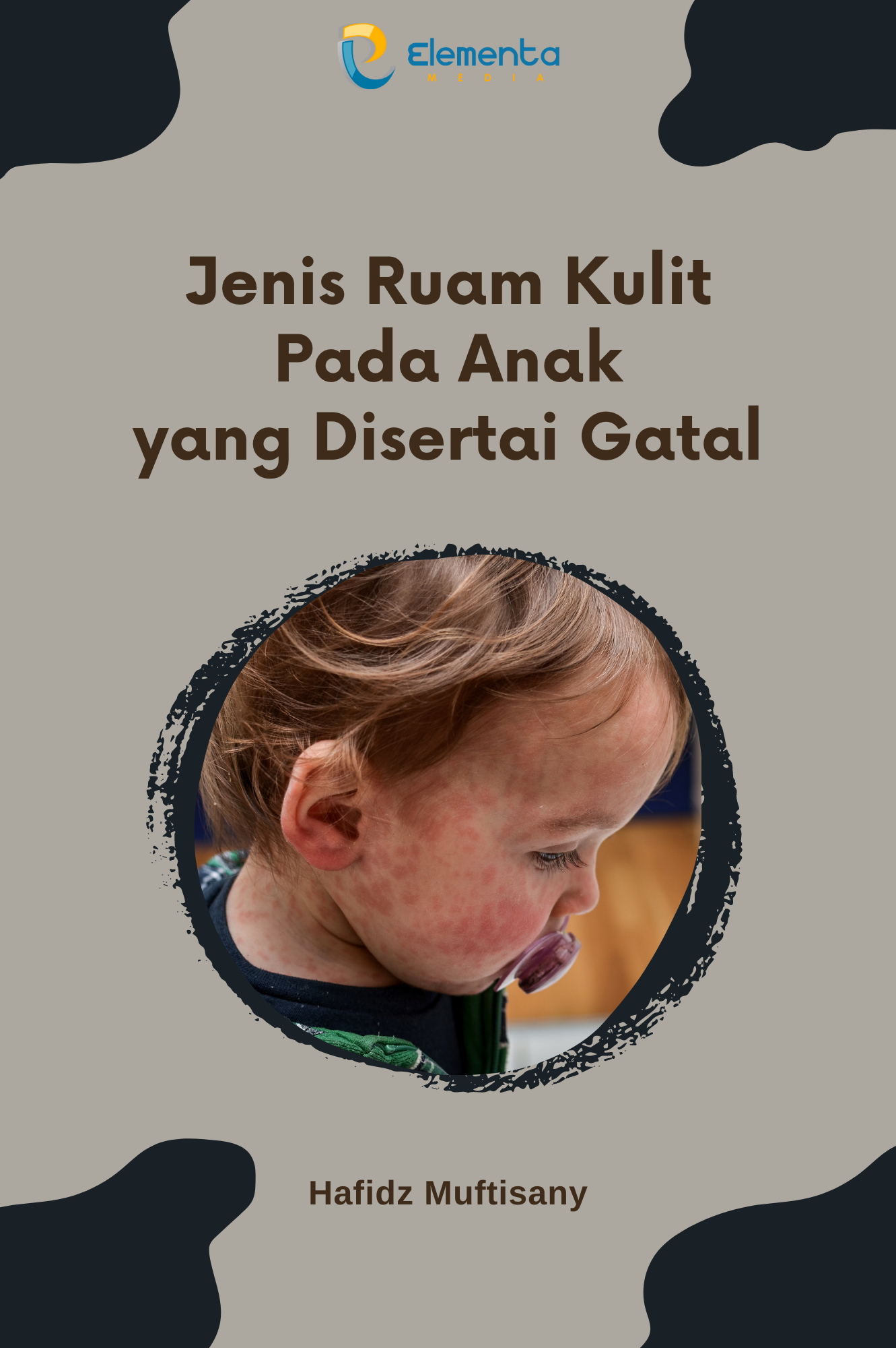 Jenis Ruam Kulit pada Anak yang Disertai Gatal