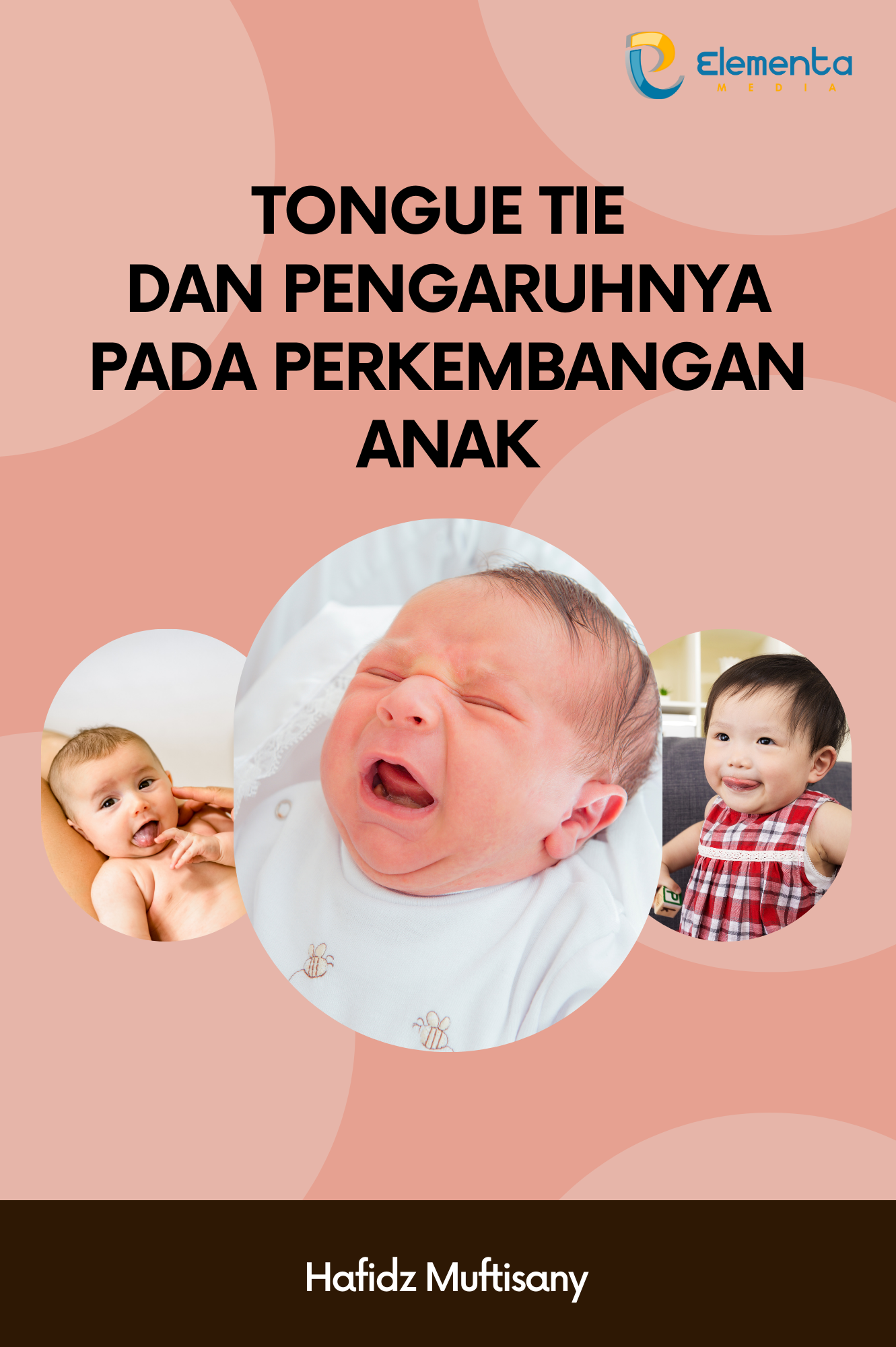 Tongue Tie dan Pengaruhnya pada Perkembangan Anak
